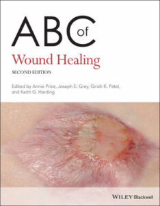 کتاب ABC of Wound Healing