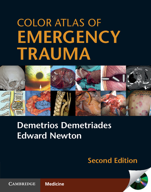 کتاب الکترونیک Color Atles of Emergency Trauma